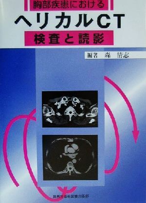 胸部疾患におけるヘリカルCT検査と読影