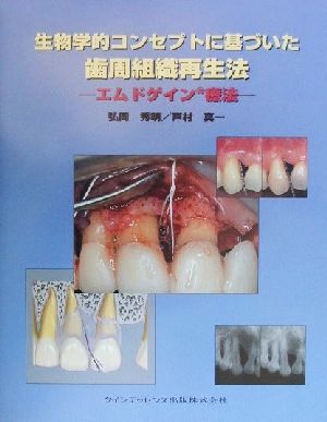 生物学的コンセプトに基づいた歯周組織再生法 エムドゲイン療法