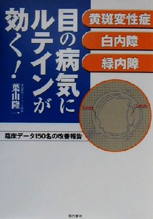 目の病気にルテインが効く！ 黄斑変性症・白内障・緑内障 臨床データ150名の改善報告