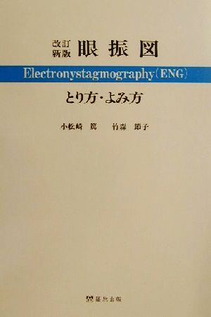 眼振図 とり方・よみ方