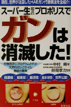 スーパー生複合プロポリスでガンは消滅した！生物因子にプログラムされた天然抗ガンミサイル機能の驚異