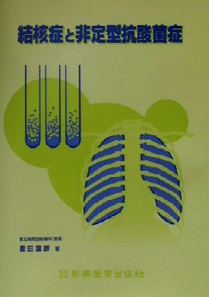 結核症と非定型抗酸菌症