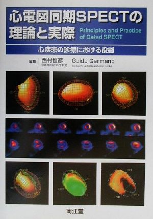 心電図同期SPECTの理論と実際 心疾患の診療における役割