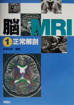 脳MRI(1)正常解剖