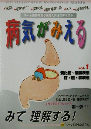 病気がみえる 消化管・腹膜疾患/肝・胆・膵疾患 第1版(vol.1)