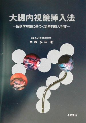 大腸内視鏡挿入法 解剖学理論に基づく定型的挿入手技