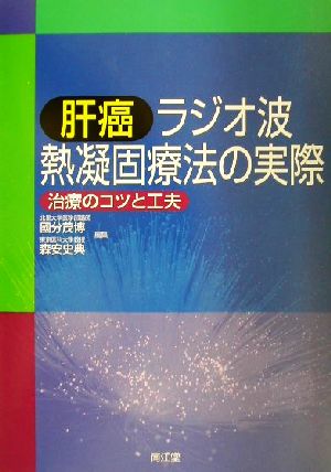 肝癌ラジオ波熱凝固療法の実際治療のコツと工夫