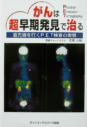 がんは超早期発見で治る 最先端を行くP.E.T検査の実態