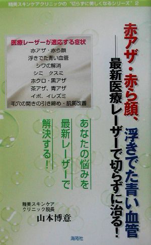 赤アザ・赤ら顔、浮きでた青い血管 最新医療レーザーで切らずに治る！