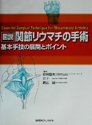 図説 関節リウマチの手術 基本手技の展開とポイント