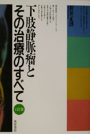 下肢静脈瘤とその治療のすべて