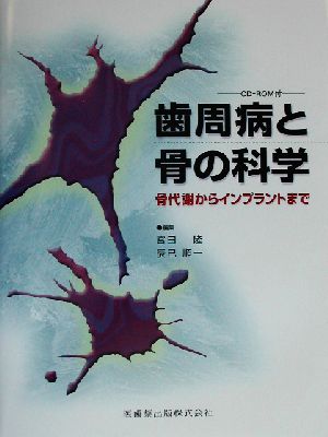 歯周病と骨の科学 骨代謝からインプラントまで