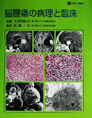 脳腫瘍の病理と臨床