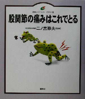 股関節の痛みはこれでとる 健康ライブラリー・イラスト版