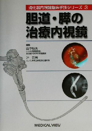 胆道・膵の治療内視鏡 消化器内視鏡臨床手技シリーズ3