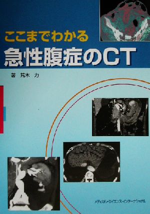 ここまでわかる急性腹症のCT 新品本・書籍 | ブックオフ公式オンライン