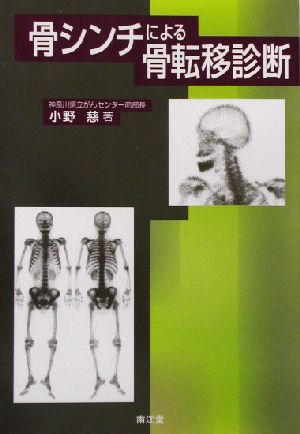 骨シンチによる骨転移診断