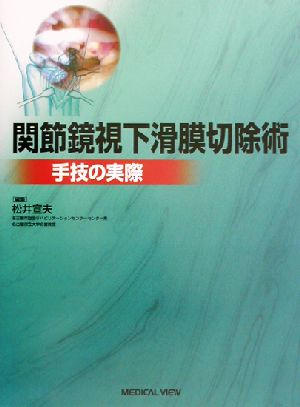 関節鏡視下滑膜切除術 手技の実際