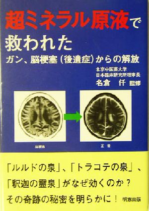 超ミネラル原液で救われたガン、脳梗塞からの解放 ガン、脳梗塞(後遺症)からの解放