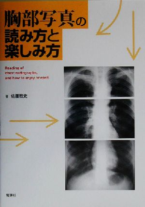 胸部写真の読み方と楽しみ方