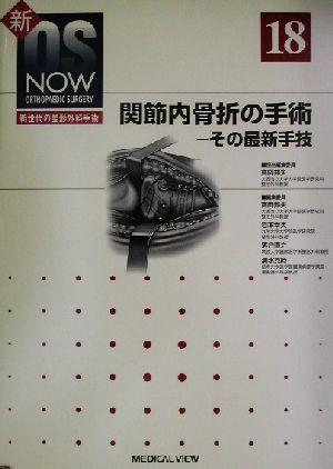 関節内骨折の手術 その最新手技 新OS NOWno.18新世代の整形外科手術No.18