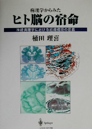 病理学からみたヒト脳の宿命 神経病理学における組織構築の意義