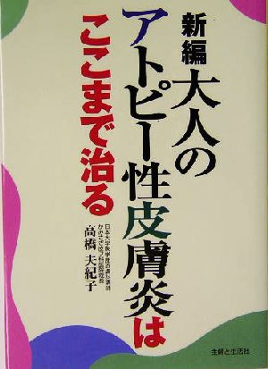 新編 大人のアトピー性皮膚炎はここまで治る