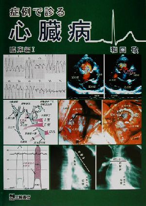 症例で診る心臓病 臨床編(1)