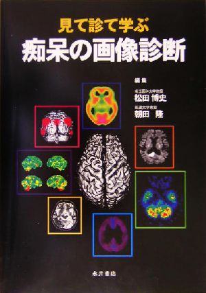 痴呆の画像診断 見て診て学ぶ