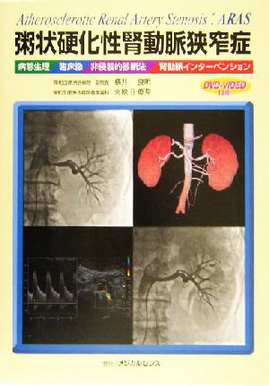 粥状硬化性腎動脈狭窄症 病態生理/臨床像/非侵襲的診断法/腎動脈インターベンション