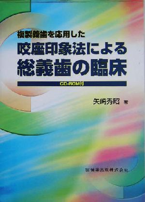 複製義歯を応用した咬座印象法による総義歯の臨床