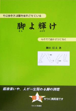 脚よ輝け その歩き方は脚を疲れさせている 歩き方で脚が丈夫になる