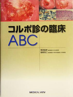 コルポ診の臨床ABC