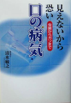 見えないから恐い口の病気 虫歯からガンまで