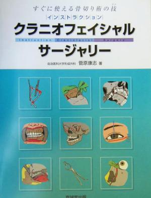 インストラクション・クラニオフェイシャルサージャリー すぐに役立つ骨切り術の技