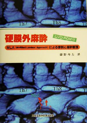 硬膜外麻酔 MLAによる穿刺と麻酔管理