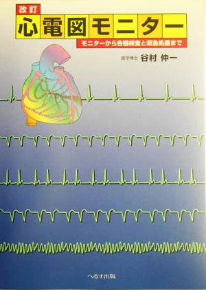 心電図モニター モニターから各種検査と緊急処置まで