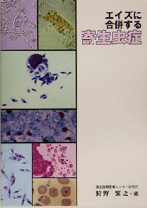 エイズに合併する寄生虫症