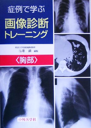 症例で学ぶ画像診断トレーニング 胸部