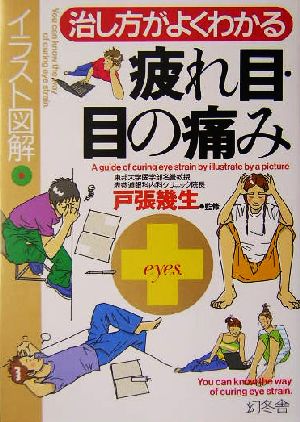 イラスト図解 治し方がよくわかる疲れ目・目の痛み イラスト図解 幻冬舎実用書芽がでるシリーズ