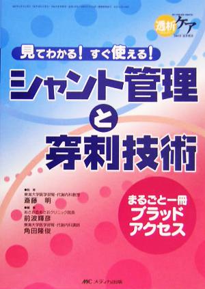 シャント管理と穿刺技術 見てわかる！すぐ使える！