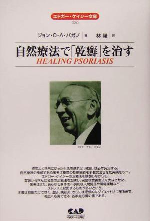 自然療法で「乾癬」を治す エドガー・ケイシー文庫