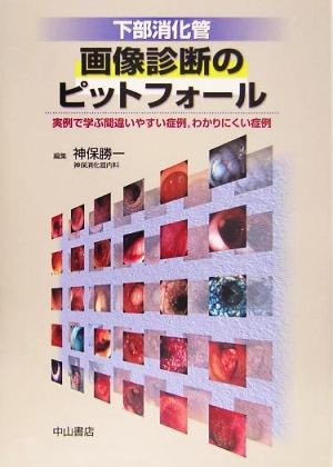 下部消化管画像診断のピットフォール 実例で学ぶ間違いやすい症例、わかりにくい症例