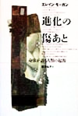 進化の傷あと 身体が語る人類の起源