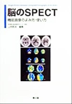 脳のSPECT 機能画像のよみ方・使い方