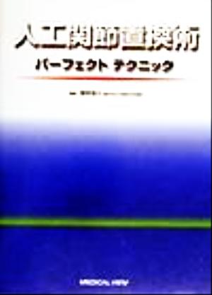 人工関節置換術 パーフェクトテクニック