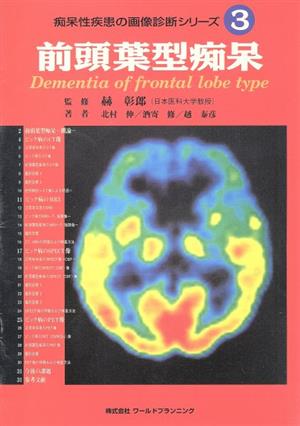 前頭葉型痴呆痴呆性疾患の画像診断シリーズ3