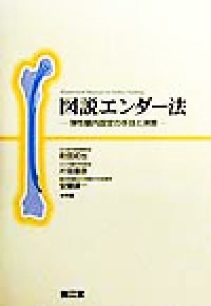 図説エンダー法 弾性髄内固定の手技と実際