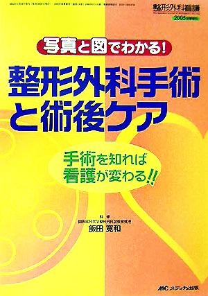 整形外科手術と術後ケア手術を知れば看護が変わる!!