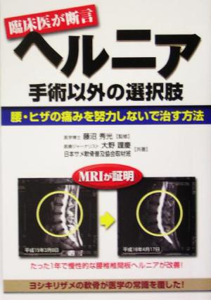 ヘルニア 手術以外の選択肢 腰・ヒザの痛みを努力しないで治す方法 元気健康ブックス